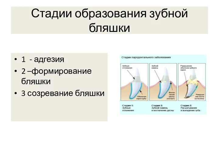 Стадии образования зубной бляшки 1 - адгезия 2 –формирование бляшки 3 созревание бляшки