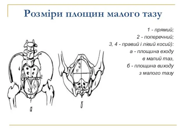 Розміри площин малого тазу 1 - прямий; 2 - поперечний;