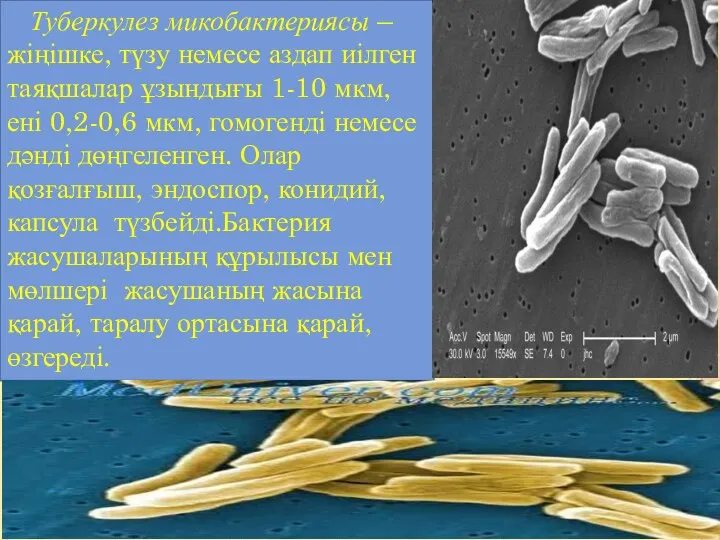 Туберкулез микобактериясы – жіңішке, түзу немесе аздап иілген таяқшалар ұзындығы