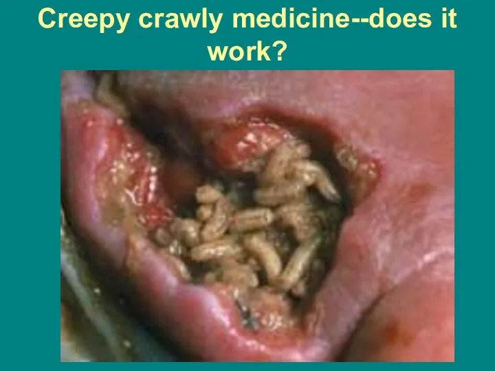 Creepy crawly medicine--does it work?