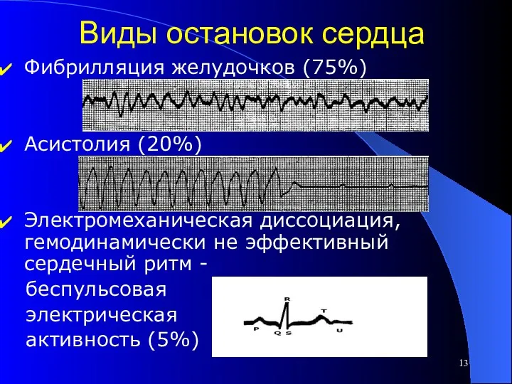 Виды остановок сердца Фибрилляция желудочков (75%) Асистолия (20%) Электромеханическая диссоциация, гемодинамически не эффективный