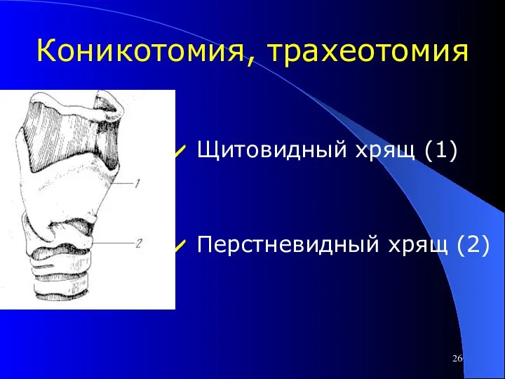 Коникотомия, трахеотомия Щитовидный хрящ (1) Перстневидный хрящ (2)