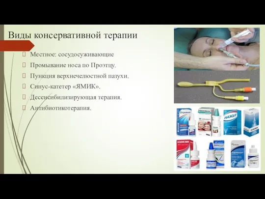 Виды консервативной терапии Местное: сосудосуживающие Промывание носа по Проэтцу. Пункция