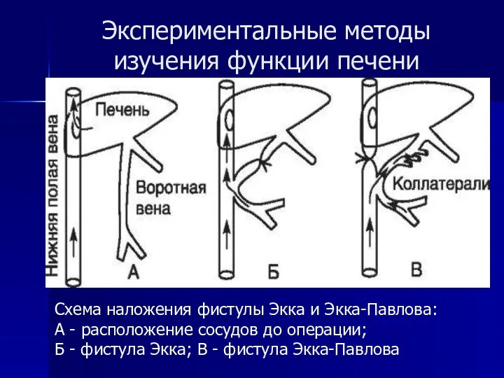 Экспериментальные методы изучения функции печени Схема наложения фистулы Экка и