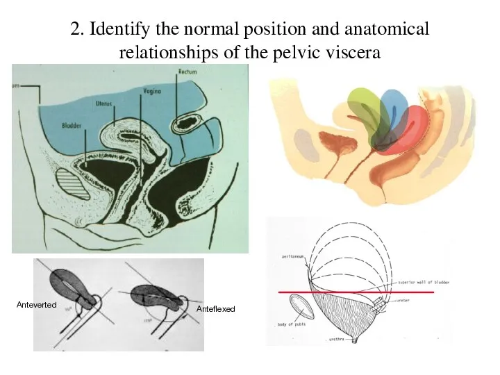 2. Identify the normal position and anatomical relationships of the pelvic viscera