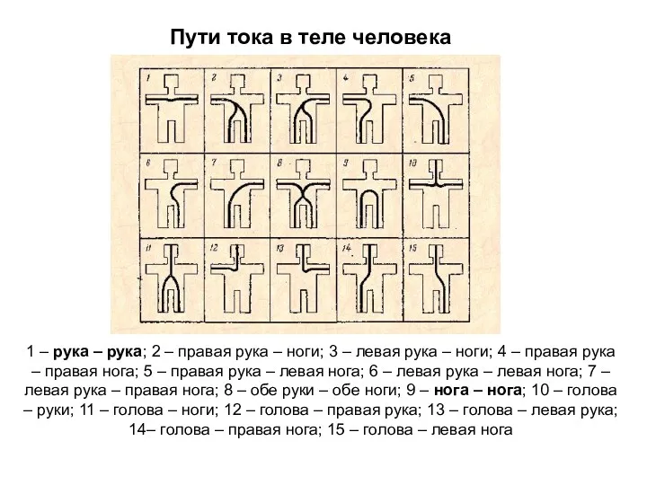 Пути тока в теле человека 1 – рука – рука;