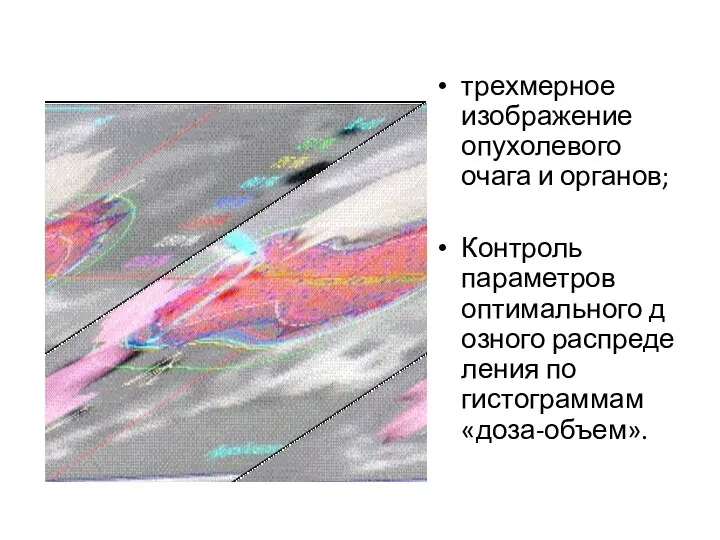 трехмерное изображение опухолевого очага и органов; Контроль параметров оптимального дозного распределения по гистограммам «доза-объем».