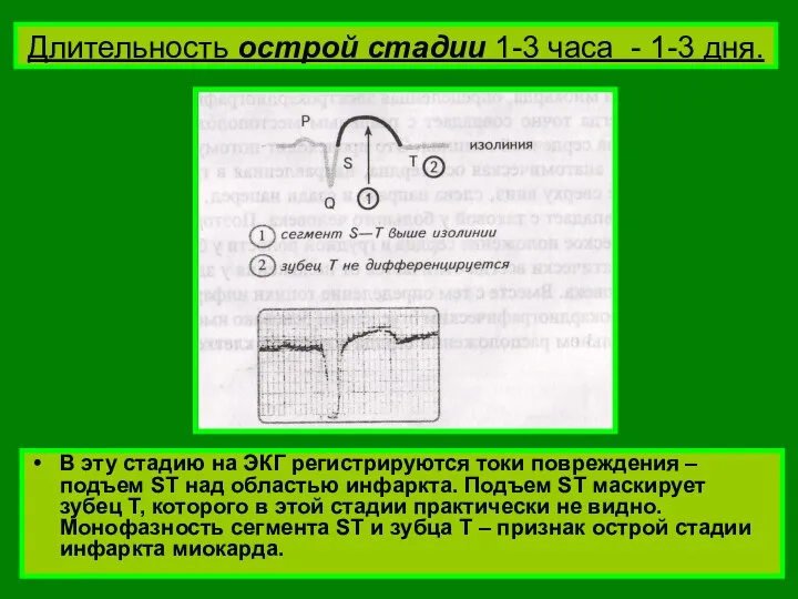 Длительность острой стадии 1-3 часа - 1-3 дня. В эту