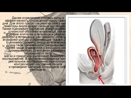 Далее определяют степень силы и эффективность сокращений мышц тазового дна.