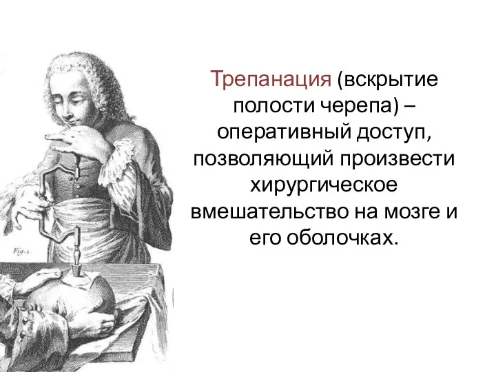 Трепанация (вскрытие полости черепа) – оперативный доступ, позволяющий произвести хирургическое вмешательство на мозге и его оболочках.