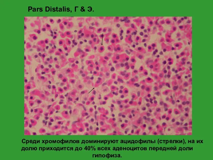 Среди хромофилов доминируют ацидофилы (стрелки), на их долю приходится до