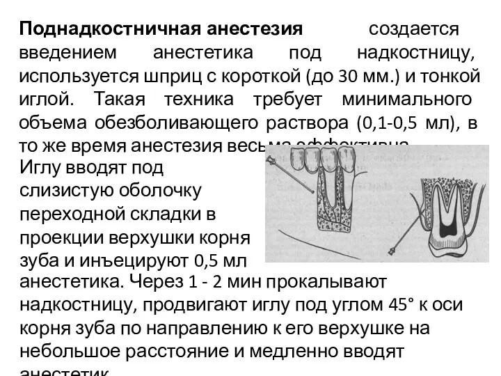 Поднадкостничная анестезия создается введением анестетика под надкостницу, используется шприц с