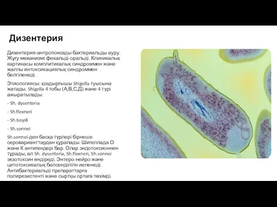 Дизентерия Дизентерия-антропонозды бактериальды ауру. Жұғу механизмі фекальді-оральді. Клиникалық картинасы комплитикалық