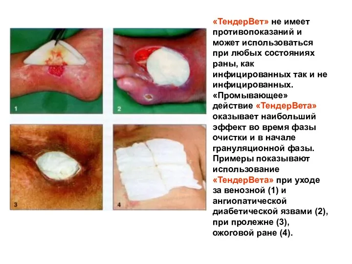 «ТендерВет» не имеет противопоказаний и может использоваться при любых состояниях