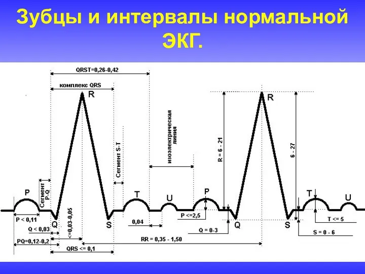 Зубцы и интервалы нормальной ЭКГ.