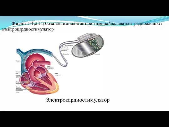 Жиілігі 1-1,2 Гц болатын имплантант ретінде пайдаланатын радиожиілікті электрокардиостимулятор Электрокардиостимулятор