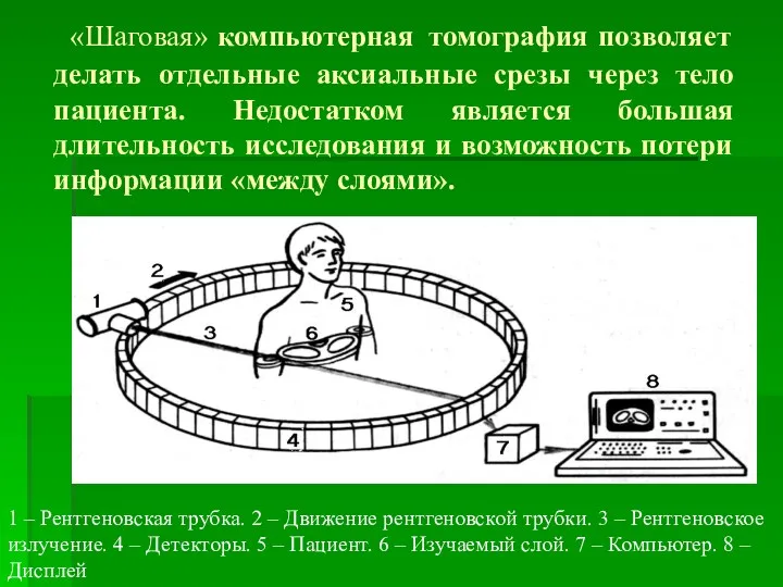 «Шаговая» компьютерная томография позволяет делать отдельные аксиальные срезы через тело