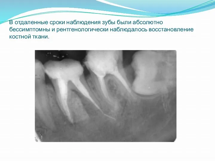 В отдаленные сроки наблюдения зубы были абсолютно бессимптомны и рентгенологически наблюдалось восстановление костной ткани.