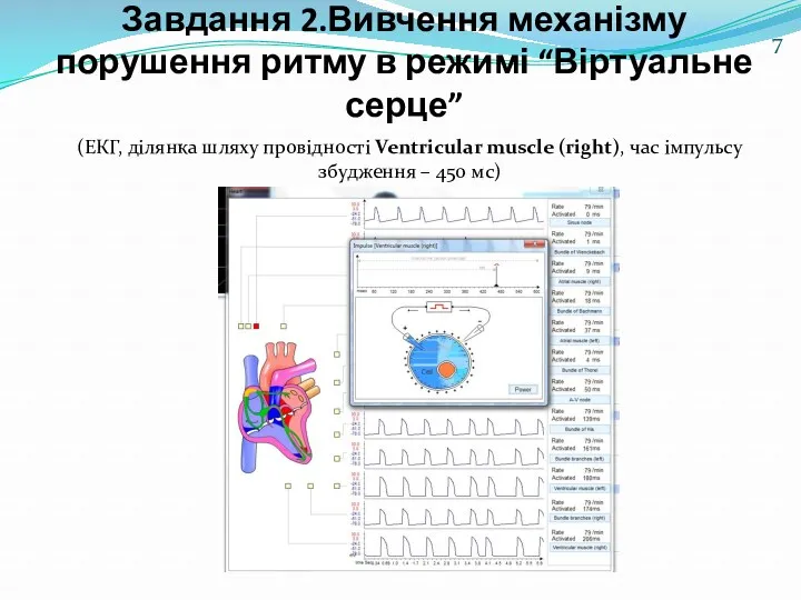Завдання 2.Вивчення механізму порушення ритму в режимі “Віртуальне серце” (ЕКГ, ділянка шляху провідності