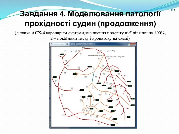 Завдання 4. Моделювання патології прохідності судин (продовження) (ділянка ACX-4 коронарної системи,зменшення просвіту цієї