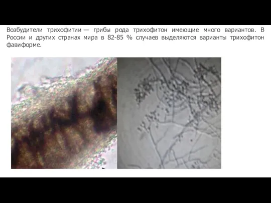 Возбудители трихофитии — грибы рода трихофитон имеющие много вариантов. В России и других