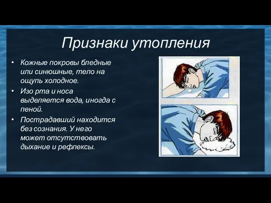 Признаки утопления Кожные покровы бледные или синюшные, тело на ощупь