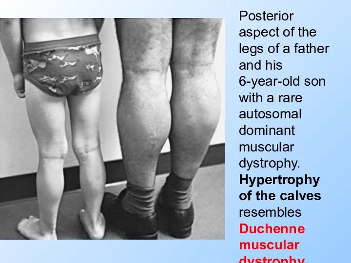 Posterior aspect of the legs of a father and his