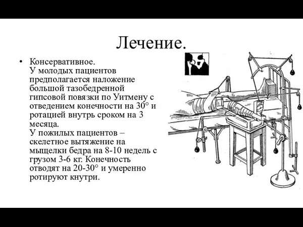 Лечение. Консервативное. У молодых пациентов предполагается наложение большой тазобедренной гипсовой