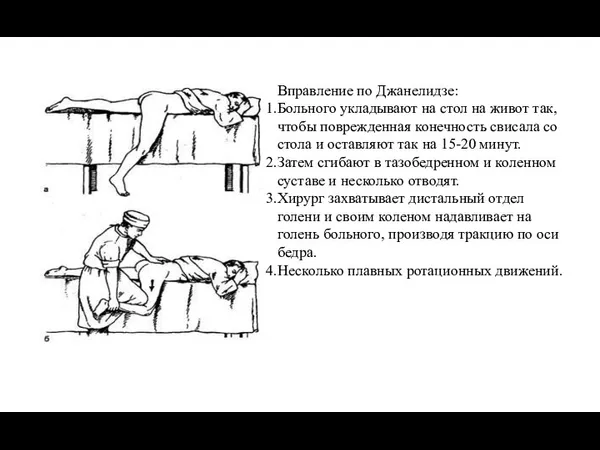 Вправление по Джанелидзе: Больного укладывают на стол на живот так,