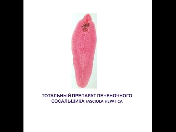 ТОТАЛЬНЫЙ ПРЕПАРАТ ПЕЧЕНОЧНОГО СОСАЛЬЩИКА FASCIOLA HEPATICA