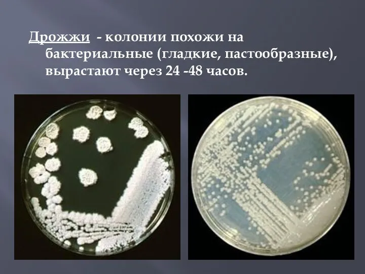 Дрожжи - колонии похожи на бактериальные (гладкие, пастообразные), вырастают через 24 -48 часов.