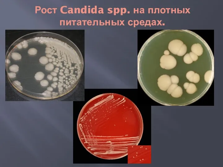 Рост Candida spp. на плотных питательных средах.