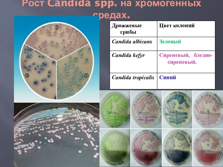 Рост Candida spp. на хромогенных средах.