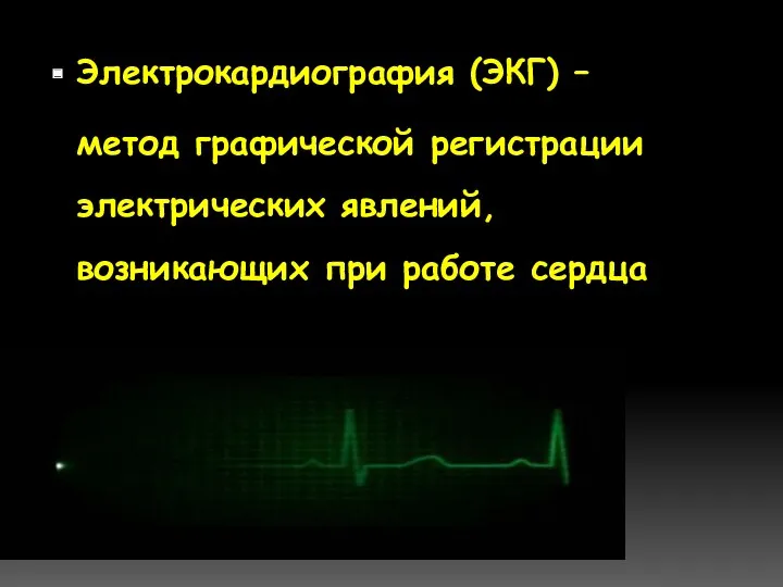 Электрокардиография (ЭКГ) – метод графической регистрации электрических явлений, возникающих при работе сердца