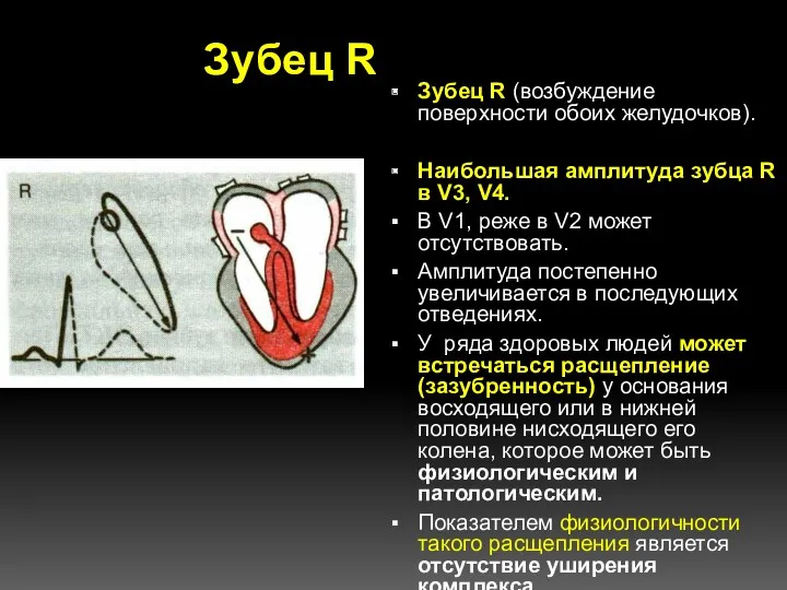 Зубец R Зубец R (возбуждение поверхности обоих желудочков). Наибольшая амплитуда зубца R в