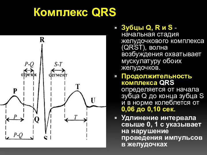 Комплекс QRS Зубцы Q, R и S - начальная стадия желудочкового комплекса (QRST),