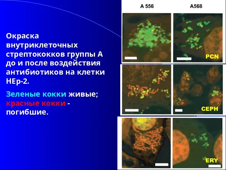 Окраска внутриклеточных стрептококков группы А до и после воздействия антибиотиков