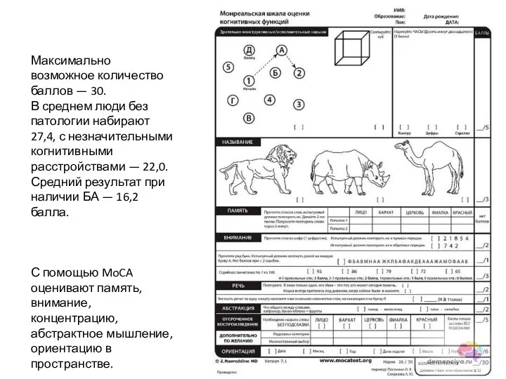 Максимально возможное количество баллов — 30. В среднем люди без патологии набирают 27,4,