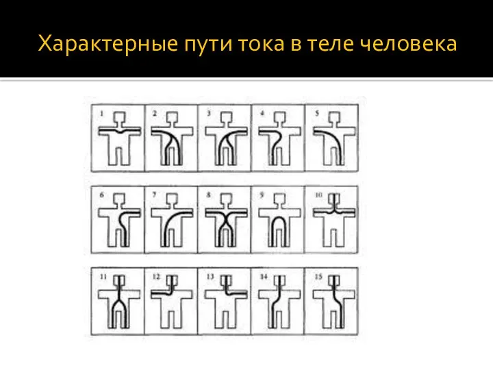 Характерные пути тока в теле человека