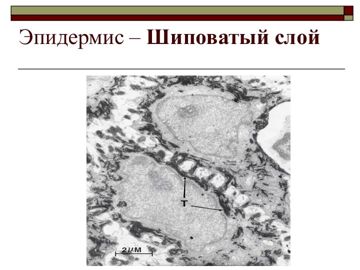 Эпидермис – Шиповатый слой