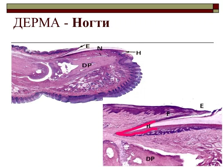 ДЕРМА - Ногти