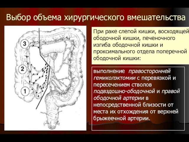 Выбор объема хирургического вмешательства