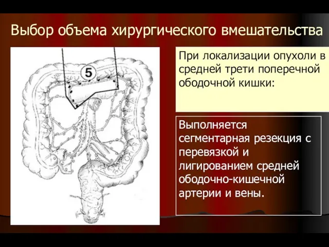 Выбор объема хирургического вмешательства