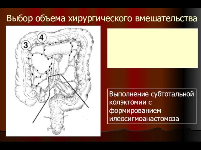 Выбор объема хирургического вмешательства