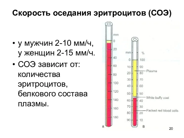 Скорость оседания эритроцитов (СОЭ) у мужчин 2-10 мм/ч, у женщин