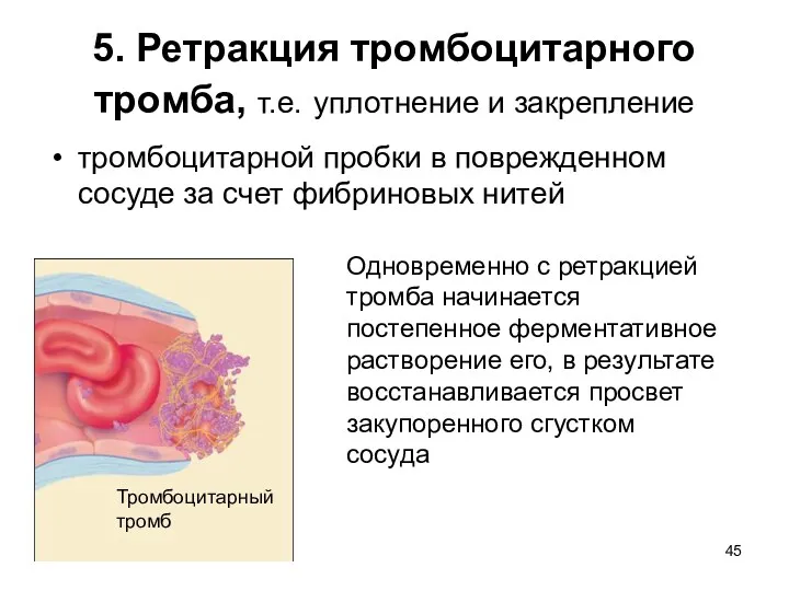 5. Ретракция тромбоцитарного тромба, т.е. уплотнение и закрепление тромбоцитарной пробки