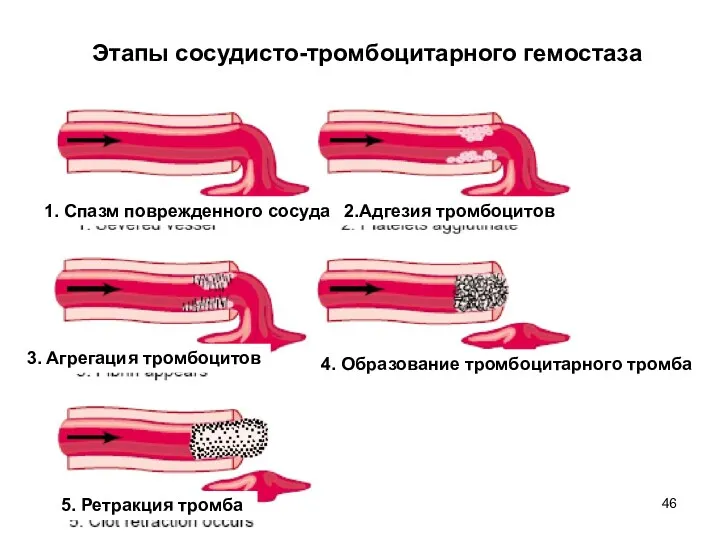 Этапы сосудисто-тромбоцитарного гемостаза 1. Спазм поврежденного сосуда 3. Агрегация тромбоцитов