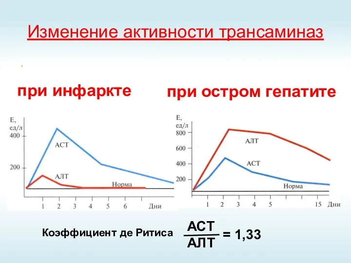 Изменение активности трансаминаз при инфаркте при остром гепатите Коэффициент де Ритиса АСТ АЛТ = 1,33