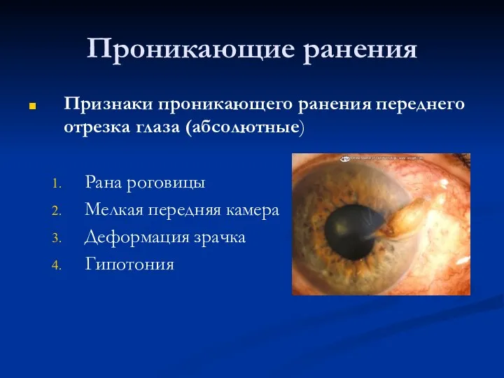 Проникающие ранения Признаки проникающего ранения переднего отрезка глаза (абсолютные) Рана