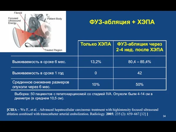 ФУЗ-абляция + ХЭПА Выборка: 50 пациентов с гепатокарциномой со стадией